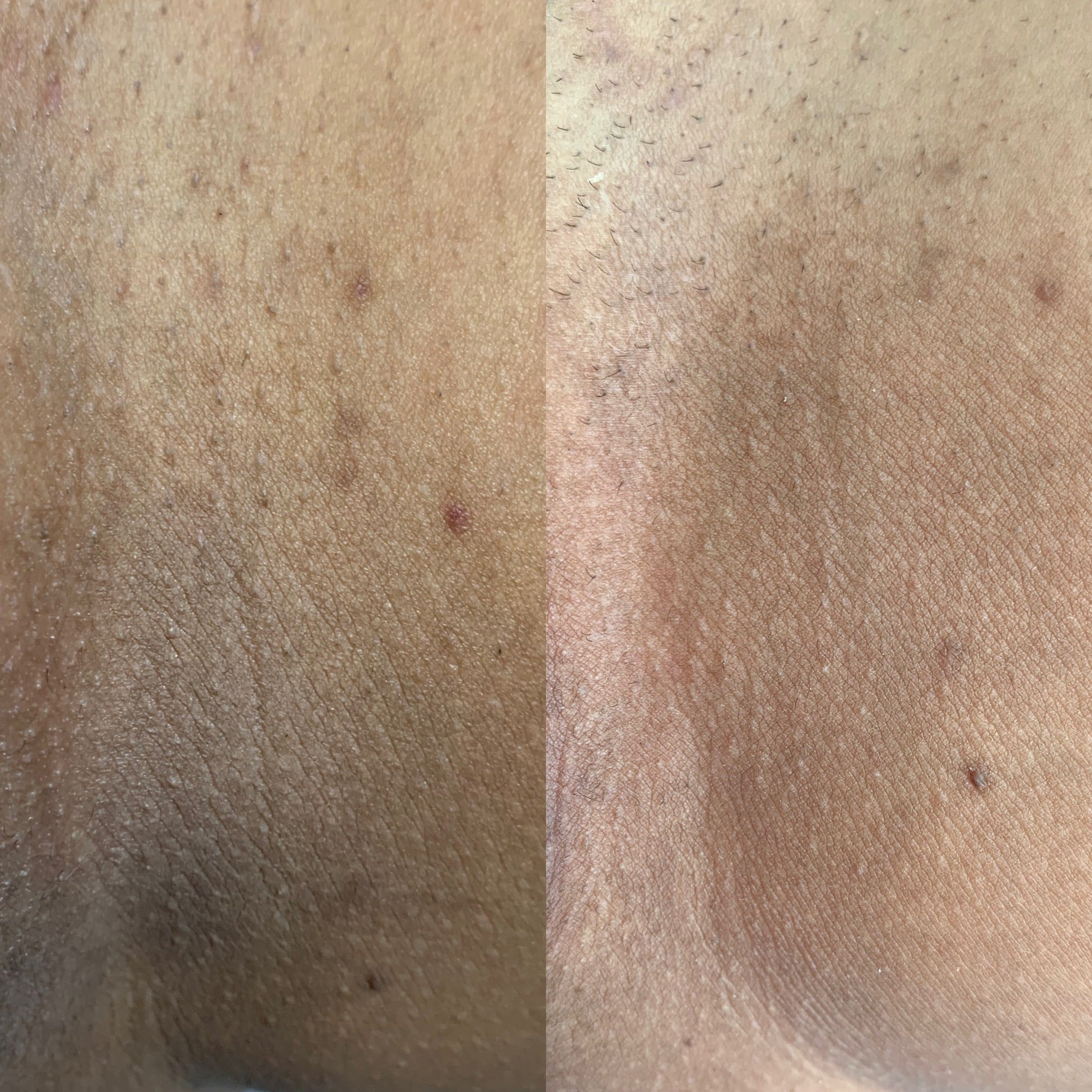 The Brightening Serum